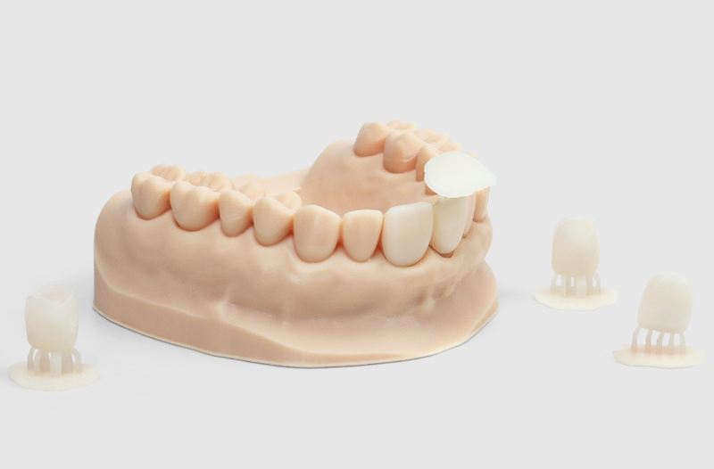 Modelos dentários impressos com a impressora Sonic XL 4K PLUS